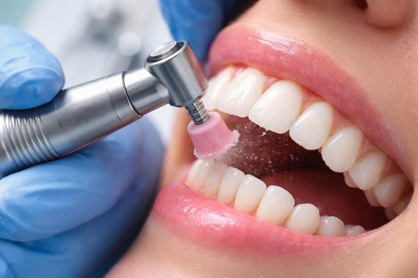 Limpeza e prevenção