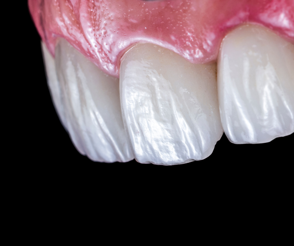 Próteses Dentárias