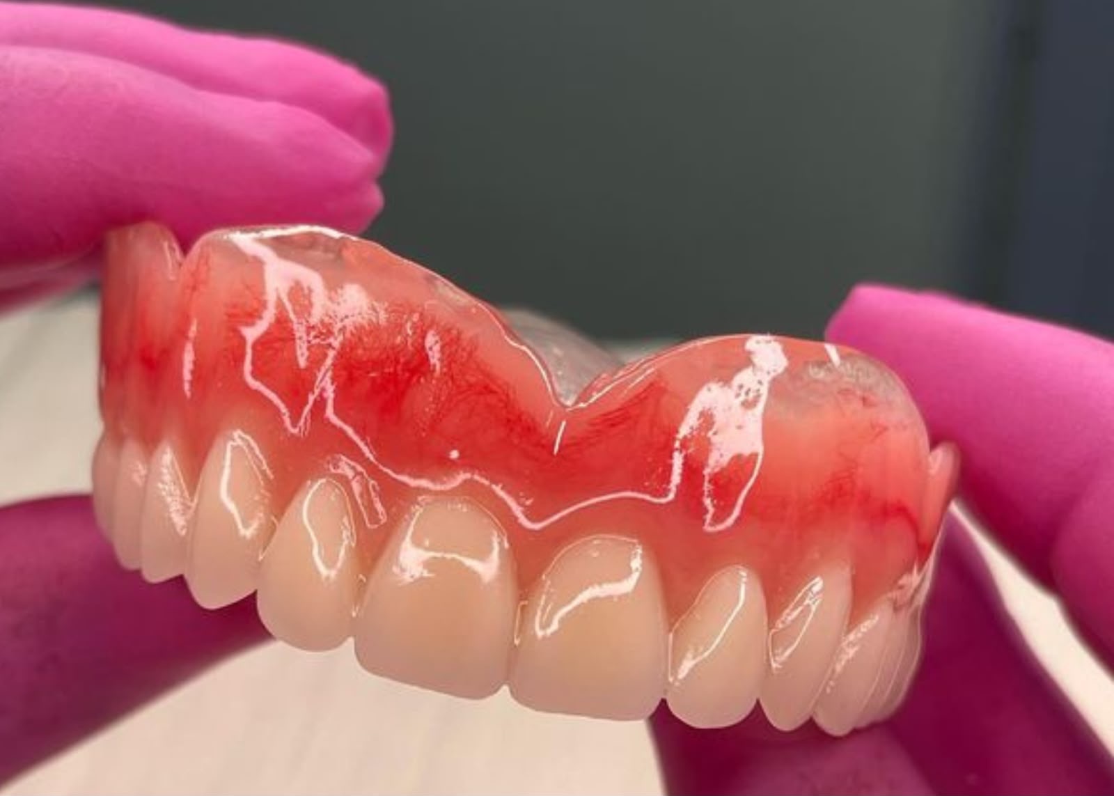 Implantes